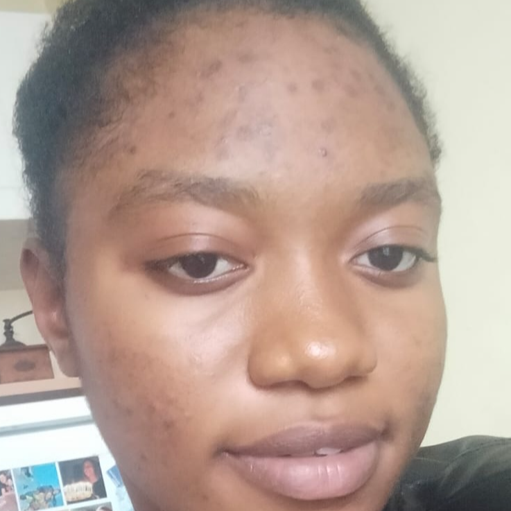 Kante Mariama