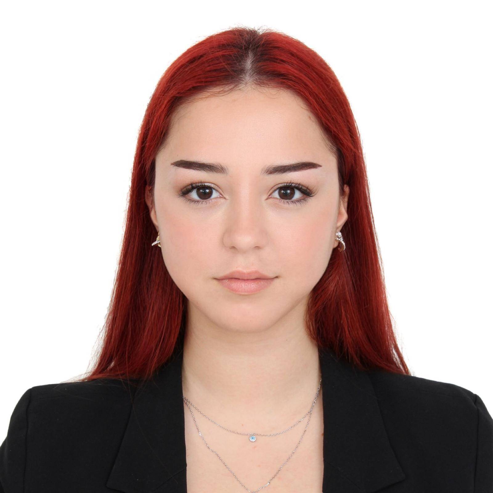 Arzu Abbasova